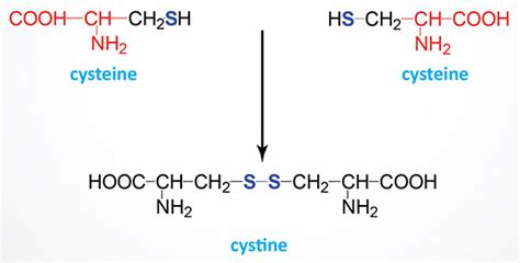 Cystinuria The Medical Biochemistry Page