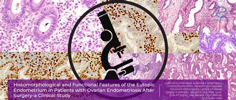 Endometrial Receptivity After The Removal Of Ovarian Endometriotic