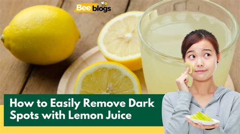 How To Easily Remove Dark Spots With Lemon Juice Everything You Need To Know Bee Blogs