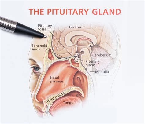 Pituitary Tumours Specialist Sydney Prof Brian Owler