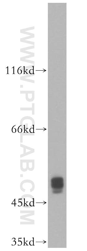 Caspase 3 P17 P19 Antibody 19677 1 AP Proteintech