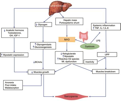 Sarcopenia In Chronic Liver Disease A Metabolic Perspective