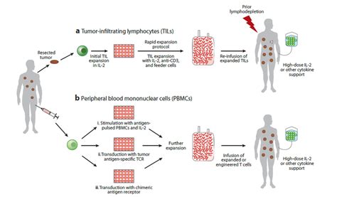 Adoptive T Cell Therapy For Metastatic Melanoma 51 Download