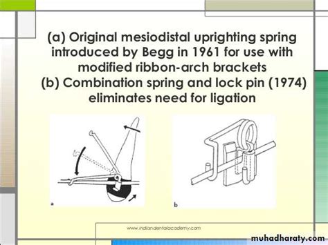 Fixed Orthodontic Appliances Pptx Drhakam Muhadharaty