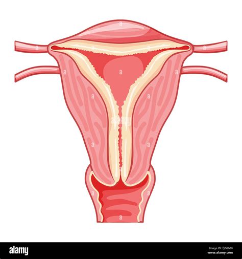 Satz Endometrialhyperplasie Weibliches Fortpflanzungssystem Uterus Mit