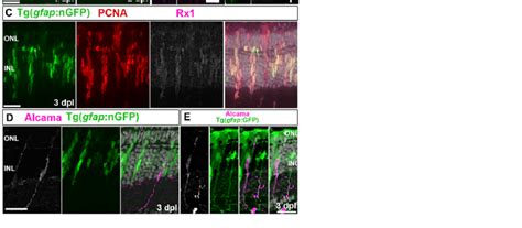 Injury induced Müller glia and retinal progenitors are distinct cell