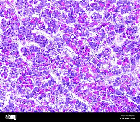 Anterior pituitary gland, light micrograph Stock Photo - Alamy