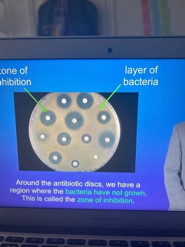 Required Practical 2 Culturing Microorganisms Flashcards Quizlet