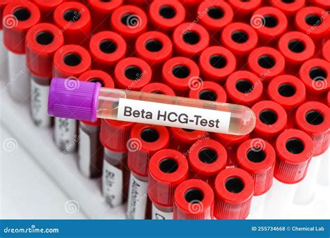 Urine Samples For Testing Hcg In The Laboratory Stock Photo Image Of