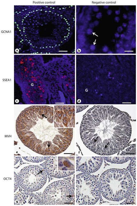 Positive And Negative Controls A Adult Mouse Testis Used As Positive