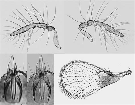 Morphology Of Trichogramma Brassicae A B Male Antennae Inner A Download Scientific