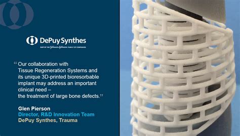 Depuy Synthes Acquires 3d Printing Technology For Patient Specific Implants 3d Printing Industry