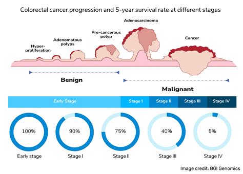 COLOTECT DNA Screening Test For Colorectal Cancer Innoquest Pathology