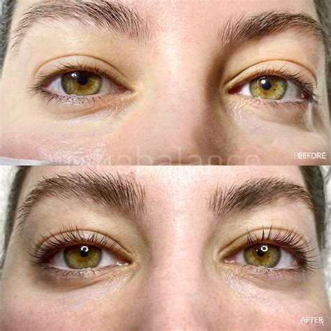 Lash Lift And Tint True Balance Medical Spa