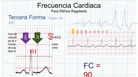 La Frecuencia Cardiaca Ppt