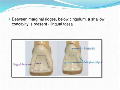 Maxillary Central Incisor Anatomy