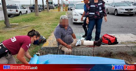 Hoy Tamaulipas Tamaulipas Motociclista Acaba Con La Pierna Destrozada