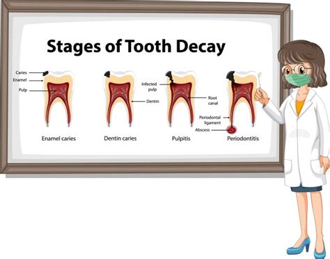 Foods That Damage Teeth And Tooth With Decay Vector Image