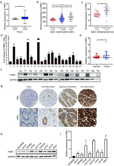 Upregulation Of Fmr1 Is Correlated With Advanced Progression Of Crc A