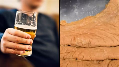 Why you shouldn't drink on an empty stomach as disturbing video shows ...