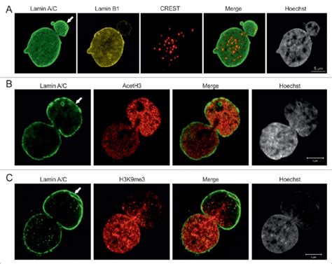 Pericentric Heterochromatin And Epigenetic Modifications Of Chromatin