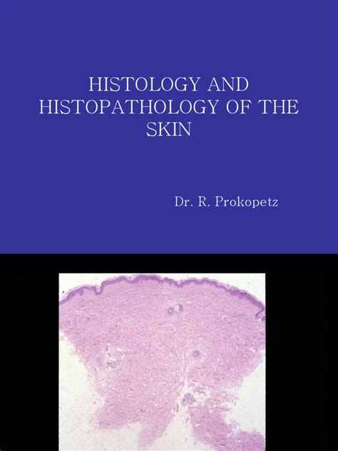 Histology And His To Pathology Of The Skin Copy06 Pdf