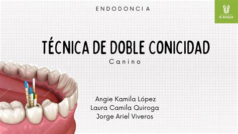 Técnica Doble Conicidad Endodoncia YouTube