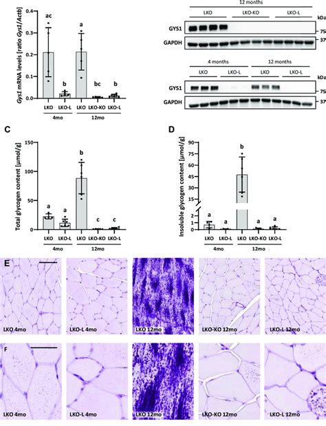 Gys Expression Glycogen And Lafora Body Accumulation In The Skeletal