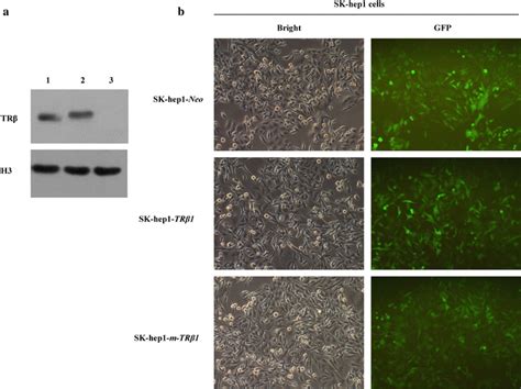 Establishment Of Human Hepatocarcinoma Sk Hep1 Cell Lines Stably