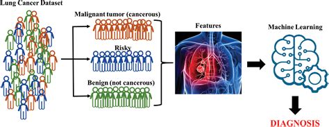 Performance Of Lung Cancer Prediction Methods Using Different