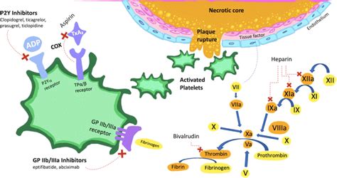 A schematic overview demonstrating acute plaque rupture and targets of ...