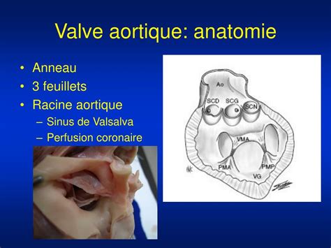 PPT La Chirurgie Cardiovasculaire PowerPoint Presentation Free