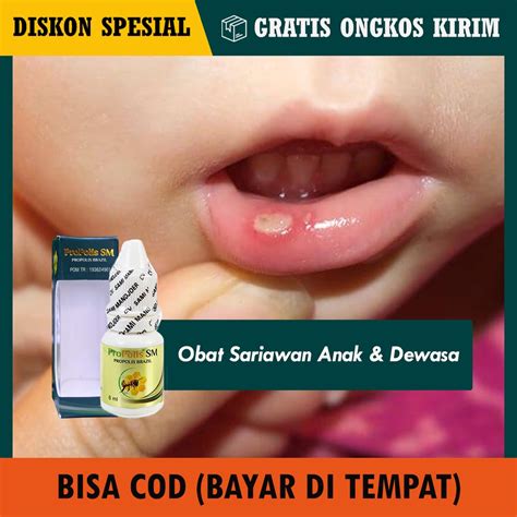 Jual COD Obat Sariawan Di Lidah Gusi Bibir Obat Luka Di Mulut