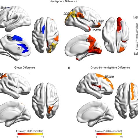 Cortical Regions With Significant Differences A Hemispheric