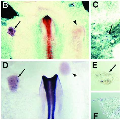 BMP-4 inhibits primitive streak formation and antagonizes organizer... | Download Scientific Diagram