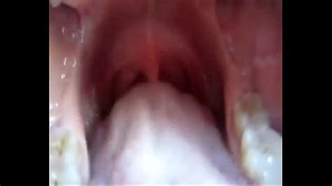 The Inside Of The Mouth Xxx Mobile Porno Videos And Movies Iporntvnet