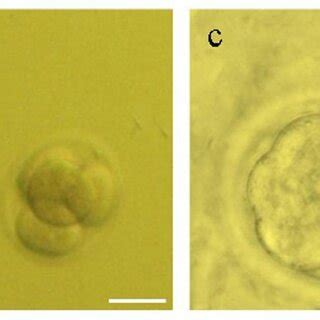 The image shows the growth and cell divisions of the embryo in ...