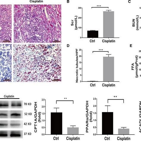 Mice With Cisplatin‐induced Aki Exhibit Fatty Acid Oxidation