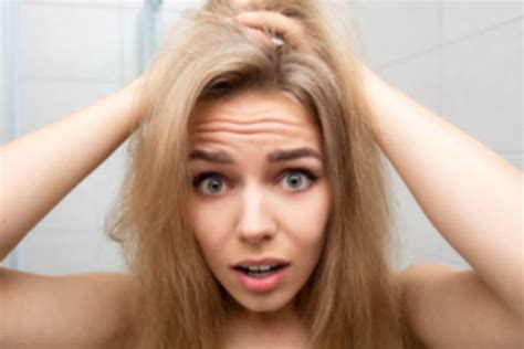 6 Treatments For Postpartum Hair Loss And Why It Happens