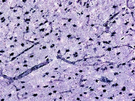 Brain Tissue Histology