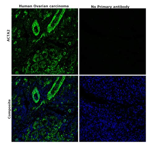 Alpha Smooth Muscle Actin Monoclonal Antibody 1a4 14 9760 82