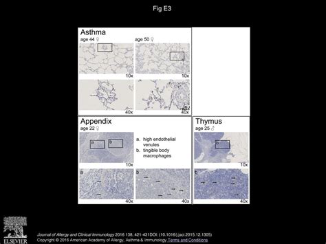 Doublesex And Mab Related Transcription Factor Dmrt Is A Sex