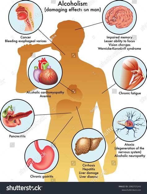 Effects Of Drinking Alcohol