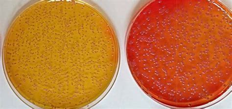 Burkholderia Cepacia Selective Agar