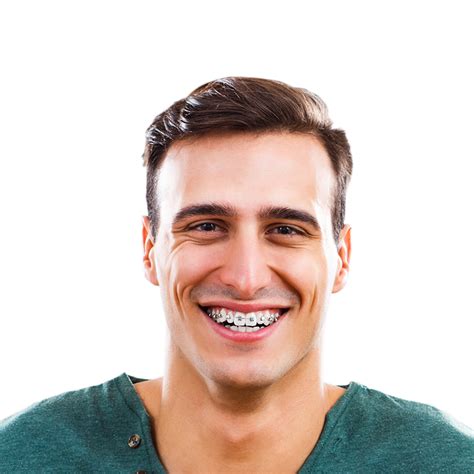 Adult Orthodontics Mitchellville, MD - Silver Spring, MD - Bowie, MD ...