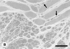 Photomicrographs With Parts Of Sections From The Midpoint Of The