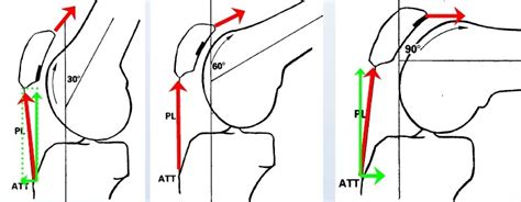 Patellofemoral Joint Knee Sports Orthobullets