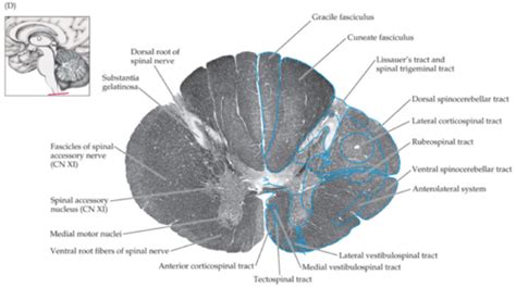 Brainstem Cross Sections Associated CN Nuclei Flashcards Quizlet