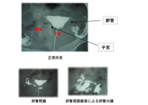 不妊治療検査 ｜ みたき総合病院 産婦人科〈三重県四日市市〉