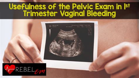 Pelvic Exam - REBEL EM - Emergency Medicine Blog